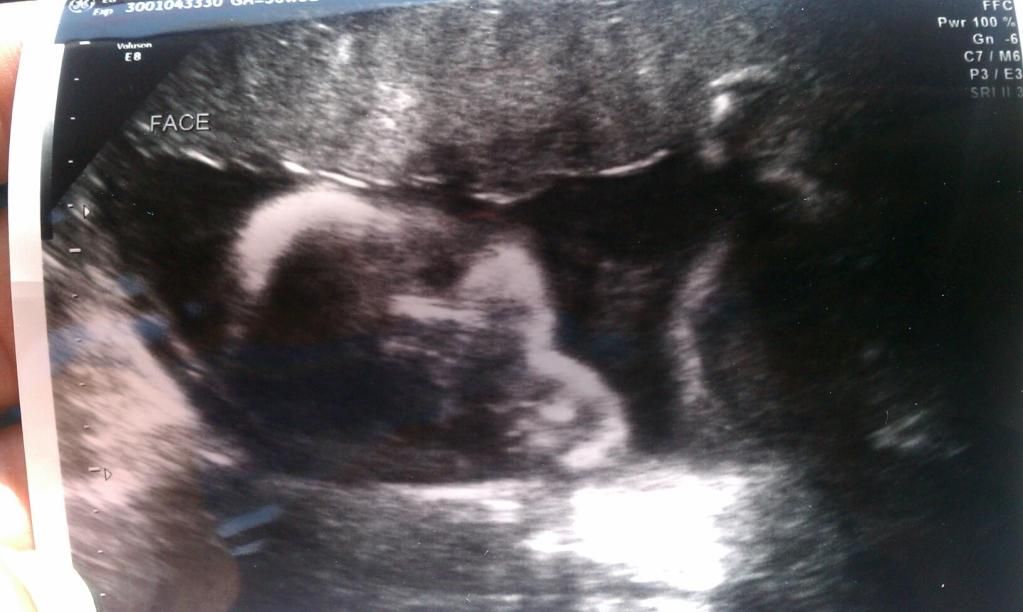 A mother can c things others can't her facial features look very similar to her brothers