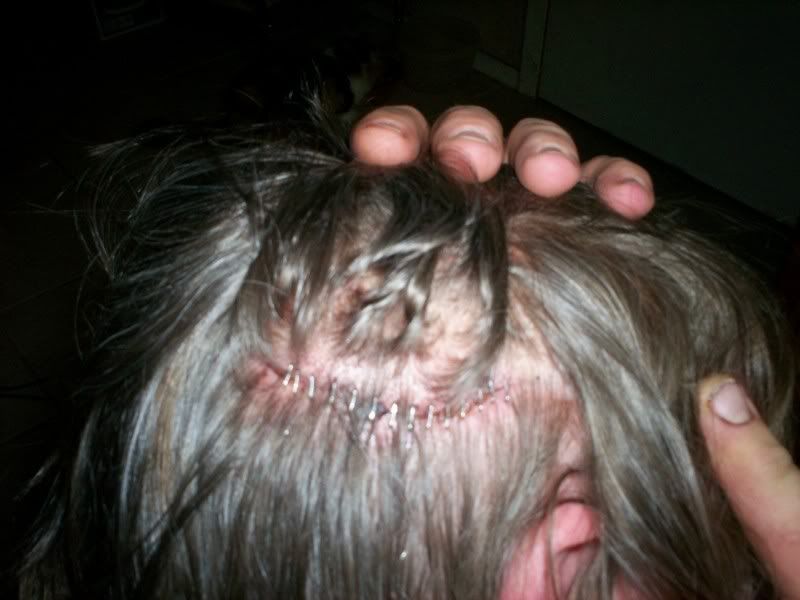 [Image: head2staples.jpg]