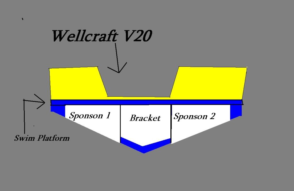 Bracekt.jpg